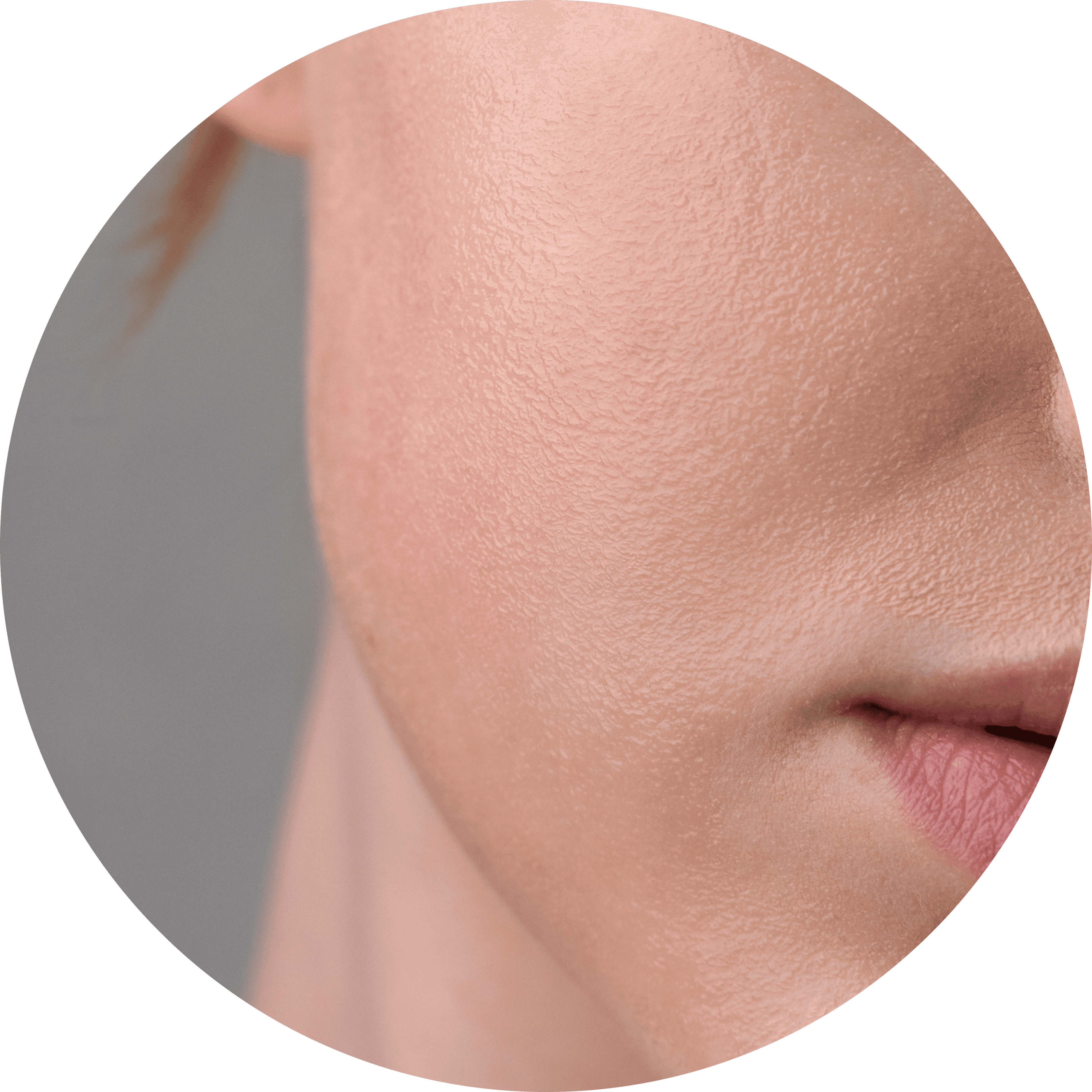 Dry Skin